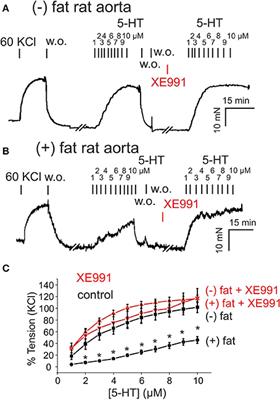 Palmitic Acid Methyl Ester and Its Relation to Control of Tone of Human Visceral Arteries and Rat Aortas by Perivascular Adipose Tissue